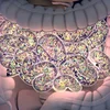 Daarmgesondheet & de Mikrobiom verstoen | © Bigstock